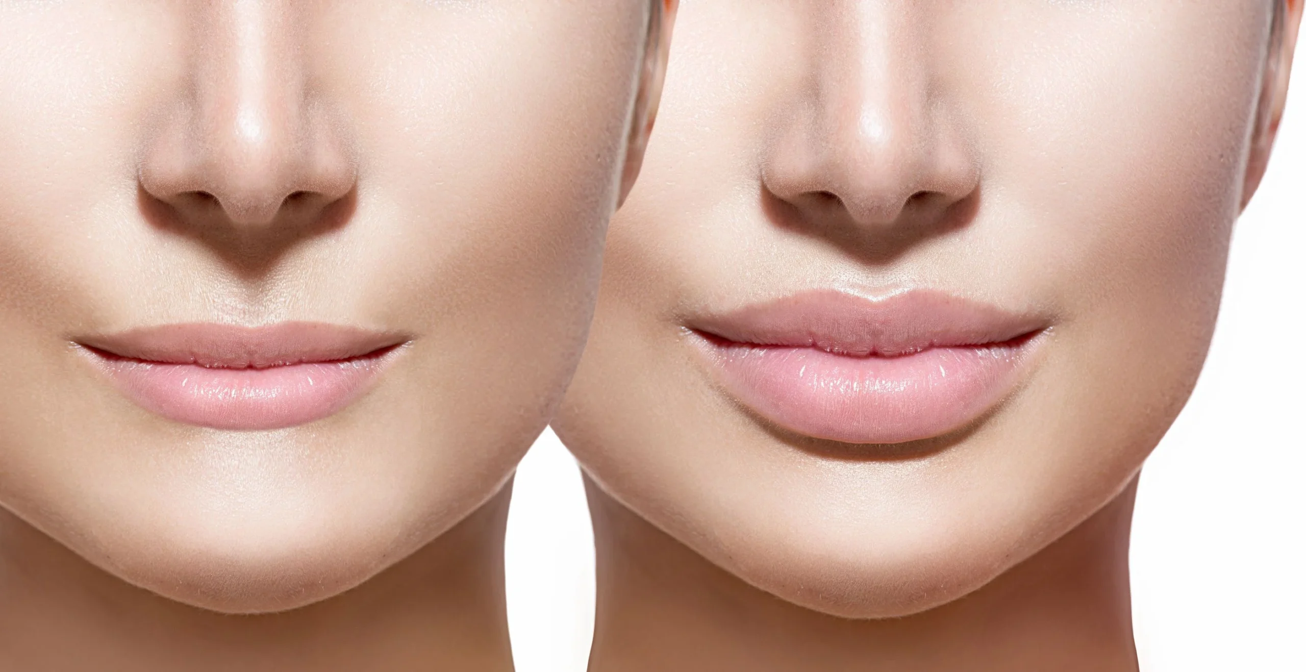 Lip Reduction