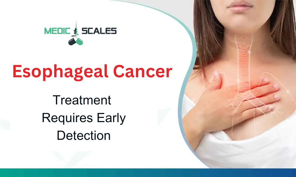 Treatment of Esophageal Cancer Requires Early Detection