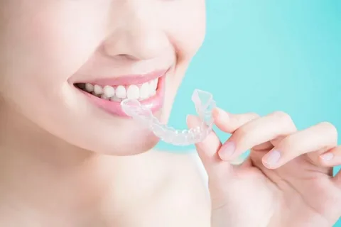 Aligners