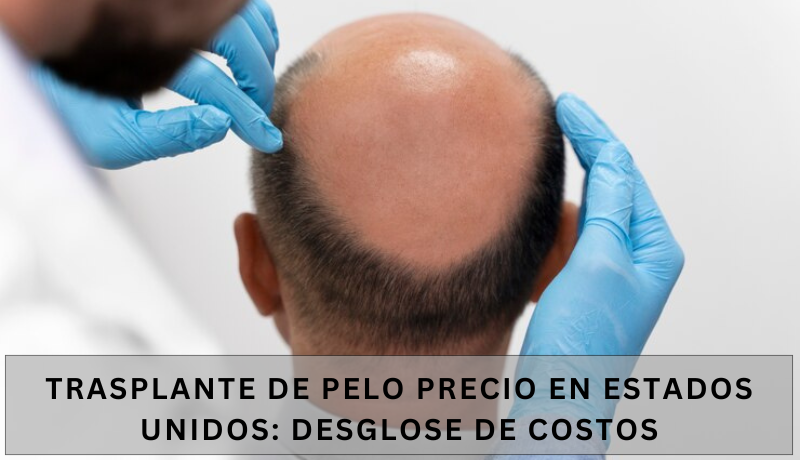 trasplante de pelo precio en estados unidos