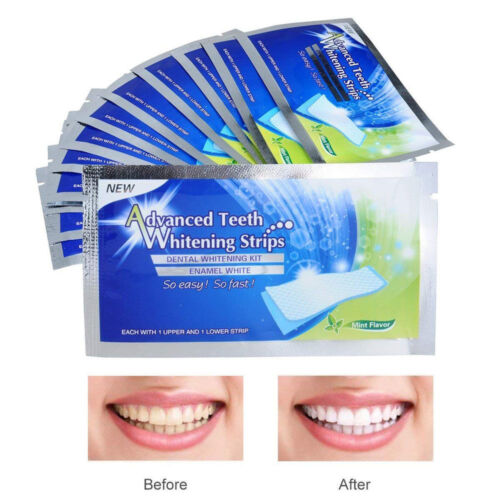 teeth whitening strips