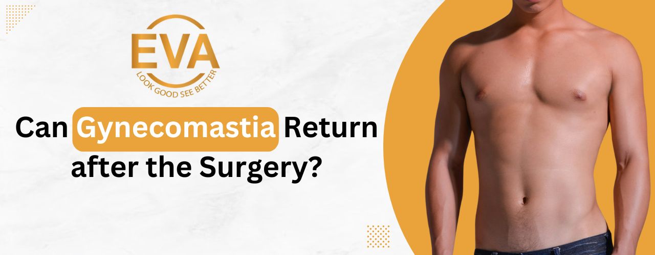 Gynecomastia Treatment in Delhi: Cost, Surgery, and Best Options