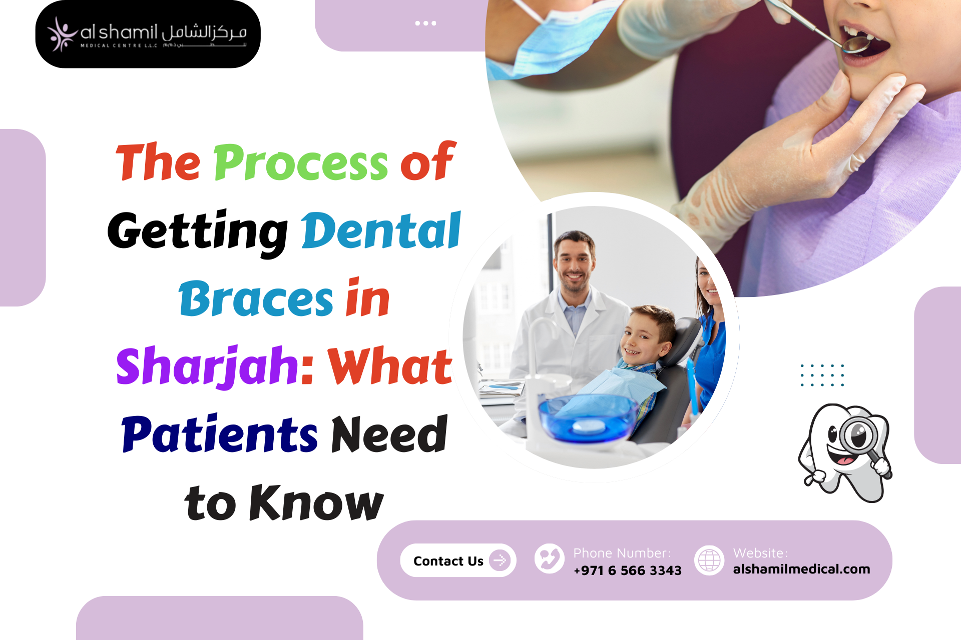 The Process of Getting Dental Braces in Sharjah